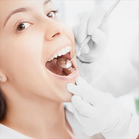 una sessione di igiene dentale - Studio Dentistico Andorno